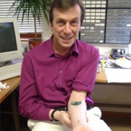 Kevin Warwick con el chip que se implantó en el brazo.